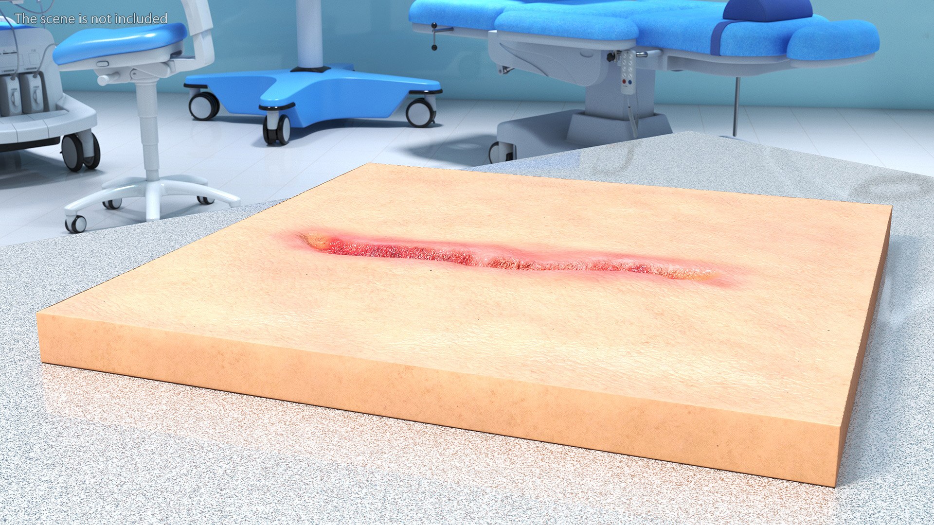 Medical Cut Skin Surfaces Collection 3D https://p.turbosquid.com/ts-thumb/7i/9Jetg6/G5/medicalcutskinsurfacescollectionc4dmodel027/jpg/1704342759/1920x1080/fit_q87/94b0a027c972611262ac0c990aeec865d484f555/medicalcutskinsurfacescollectionc4dmodel027.jpg