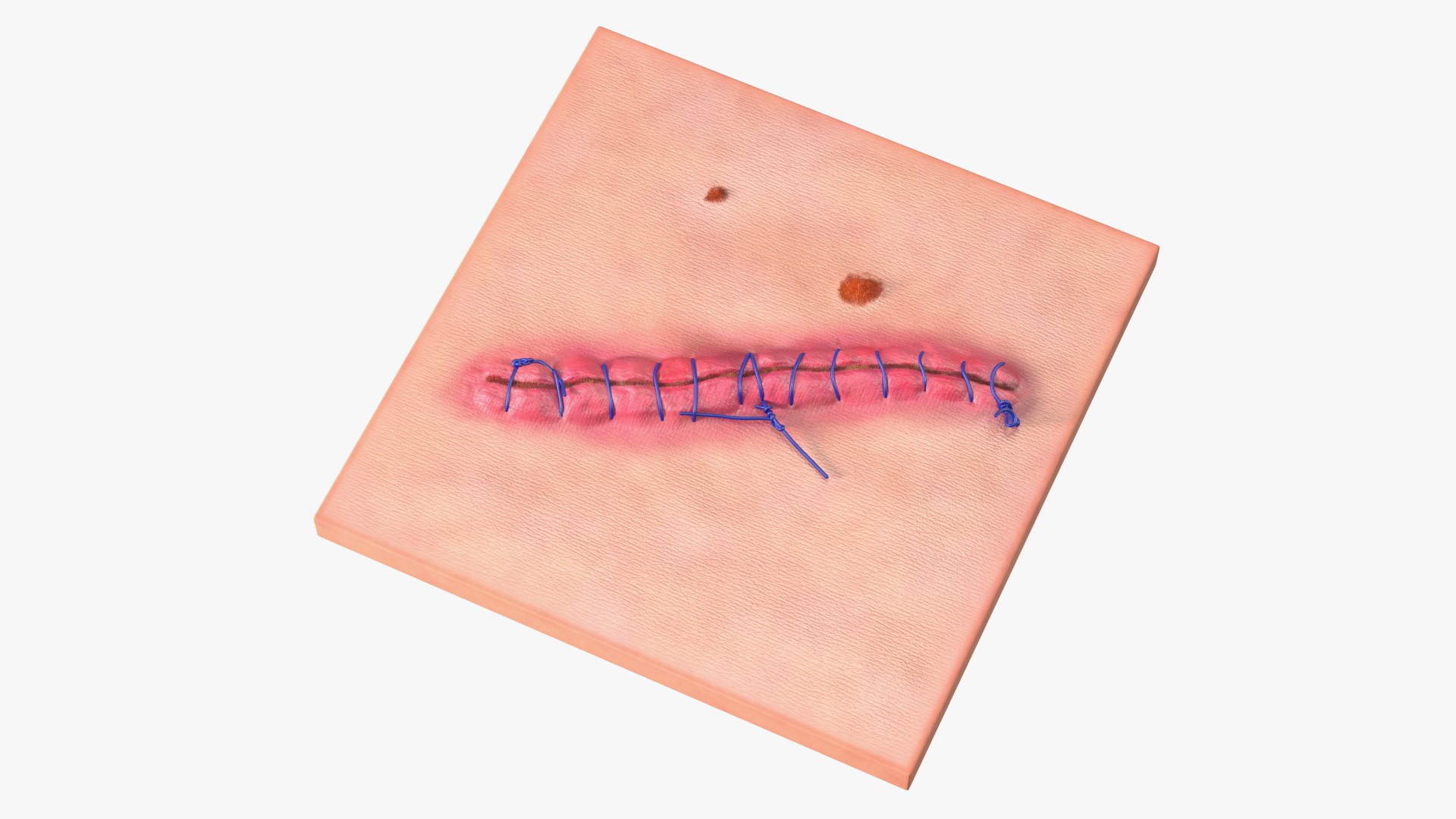 Medical Cut Skin Surfaces Collection 3D https://p.turbosquid.com/ts-thumb/7i/9Jetg6/JR/medicalcutskinsurfacescollectionc4dmodel009/jpg/1704342695/1920x1080/fit_q87/9cc5b5fa497bd7de2c8a469e94c59dd64fdca339/medicalcutskinsurfacescollectionc4dmodel009.jpg