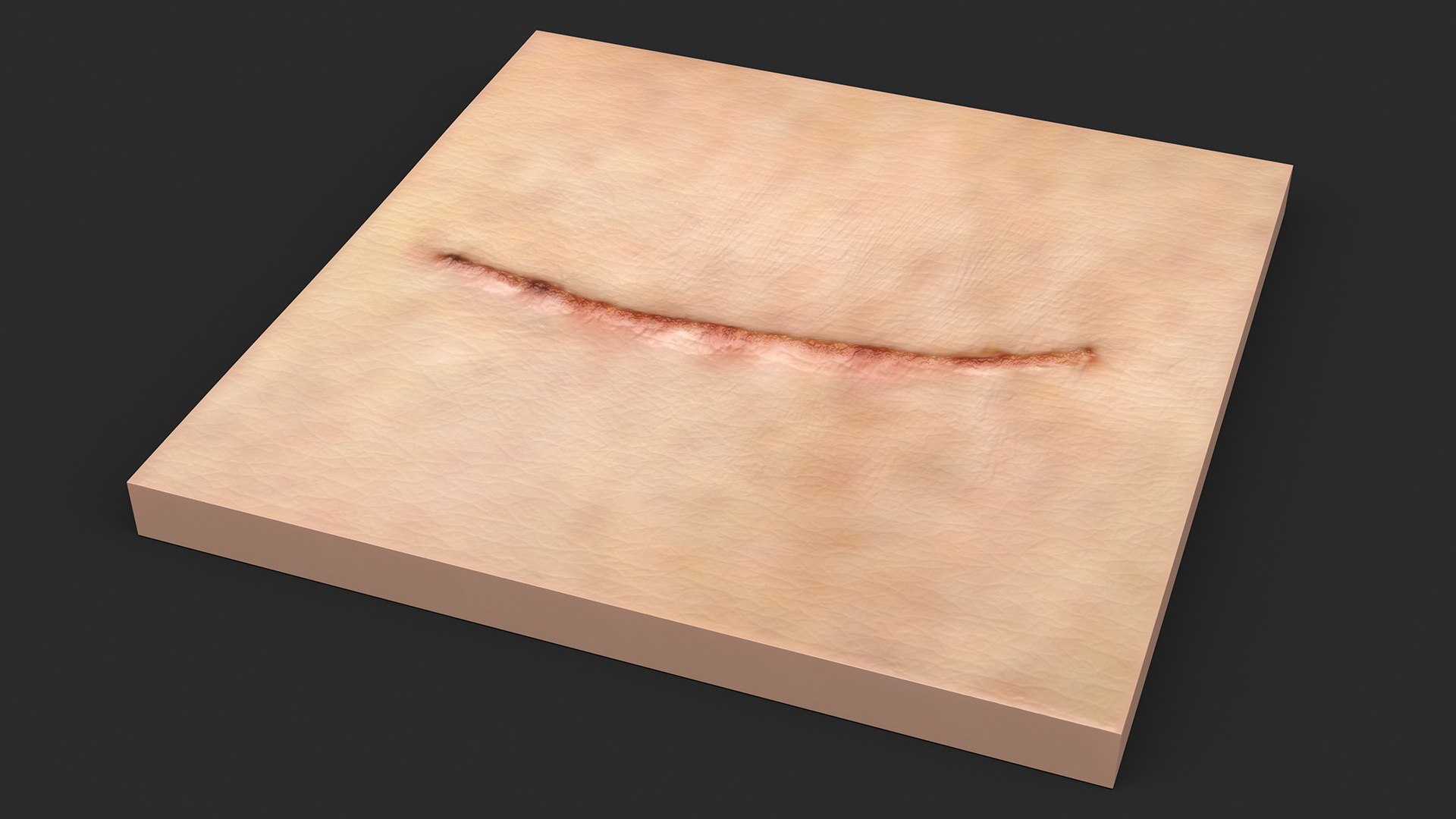 Medical Cut Skin Surfaces Collection 3D https://p.turbosquid.com/ts-thumb/7i/9Jetg6/RG/medicalcutskinsurfacescollectionc4dmodel019/jpg/1704342732/1920x1080/fit_q87/567177870c4450dd52154f5da1eaeba41ee9b431/medicalcutskinsurfacescollectionc4dmodel019.jpg