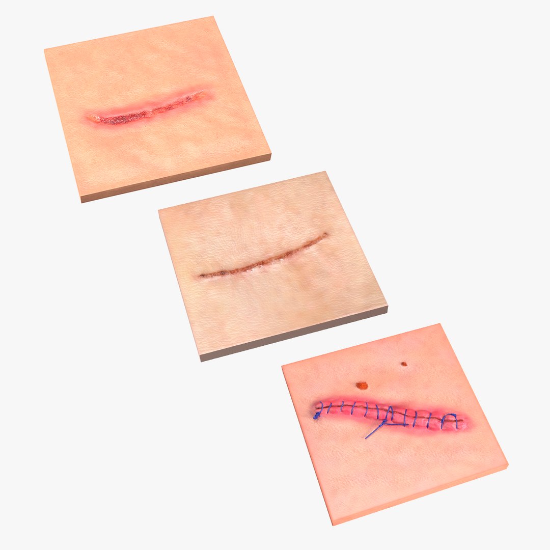 Medical Cut Skin Surfaces Collection 3D model preview