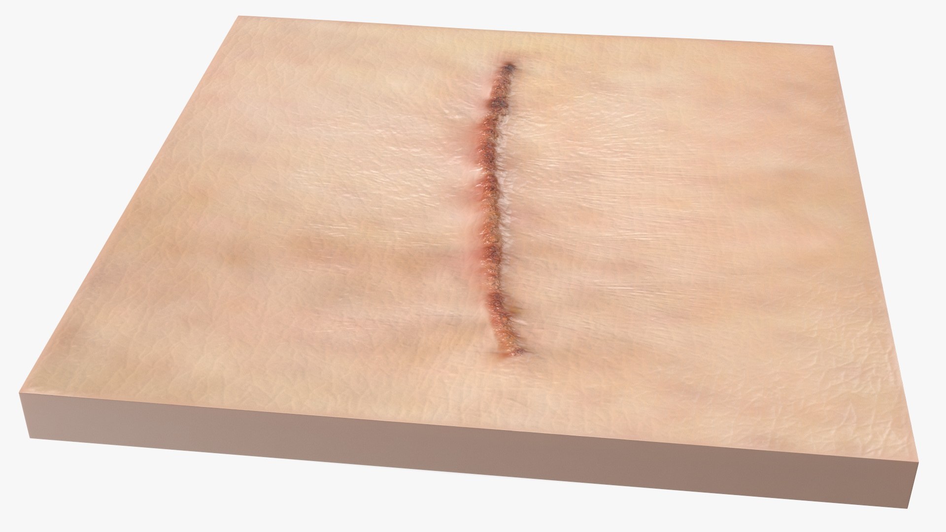 Medical Cut Skin Surfaces Collection 3D https://p.turbosquid.com/ts-thumb/7i/9Jetg6/hL/medicalcutskinsurfacescollectionc4dmodel024/jpg/1704342749/1920x1080/fit_q87/47ab37739ffb188dbe9946011e005edd93cff17c/medicalcutskinsurfacescollectionc4dmodel024.jpg