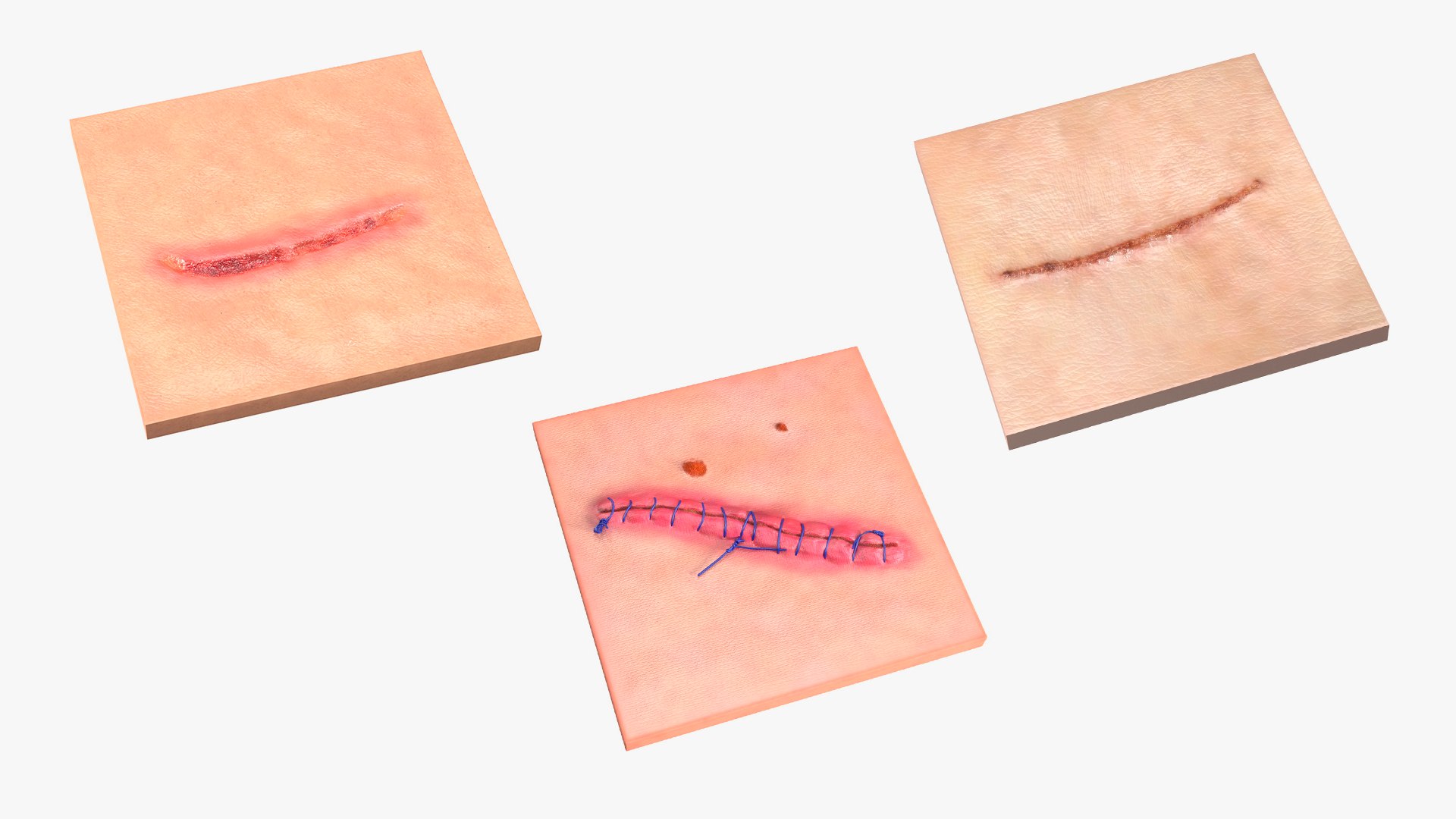 Medical Cut Skin Surfaces Collection 3D https://p.turbosquid.com/ts-thumb/7i/9Jetg6/tX/medicalcutskinsurfacescollectionc4dmodel001/jpg/1704341613/1920x1080/fit_q87/6625871ab2aa9368d6e6e51e1e4ec1fbb8dbb6dc/medicalcutskinsurfacescollectionc4dmodel001.jpg