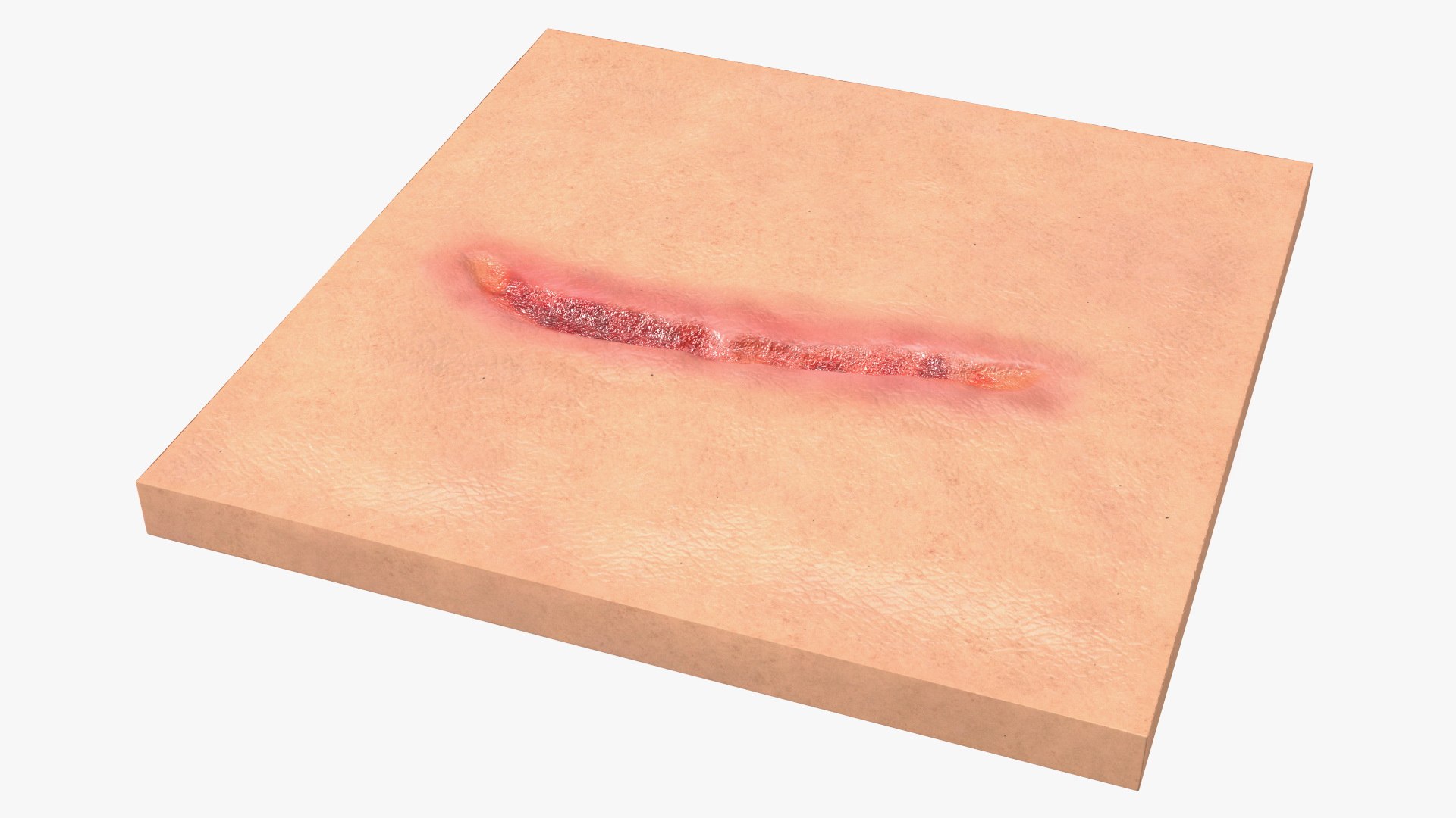 Medical Cut Skin Surfaces Collection 3D https://p.turbosquid.com/ts-thumb/7i/9Jetg6/uL/medicalcutskinsurfacescollectionc4dmodel035/jpg/1704342789/1920x1080/fit_q87/b71629506d7743984c848497e1f4e11ff08e5030/medicalcutskinsurfacescollectionc4dmodel035.jpg