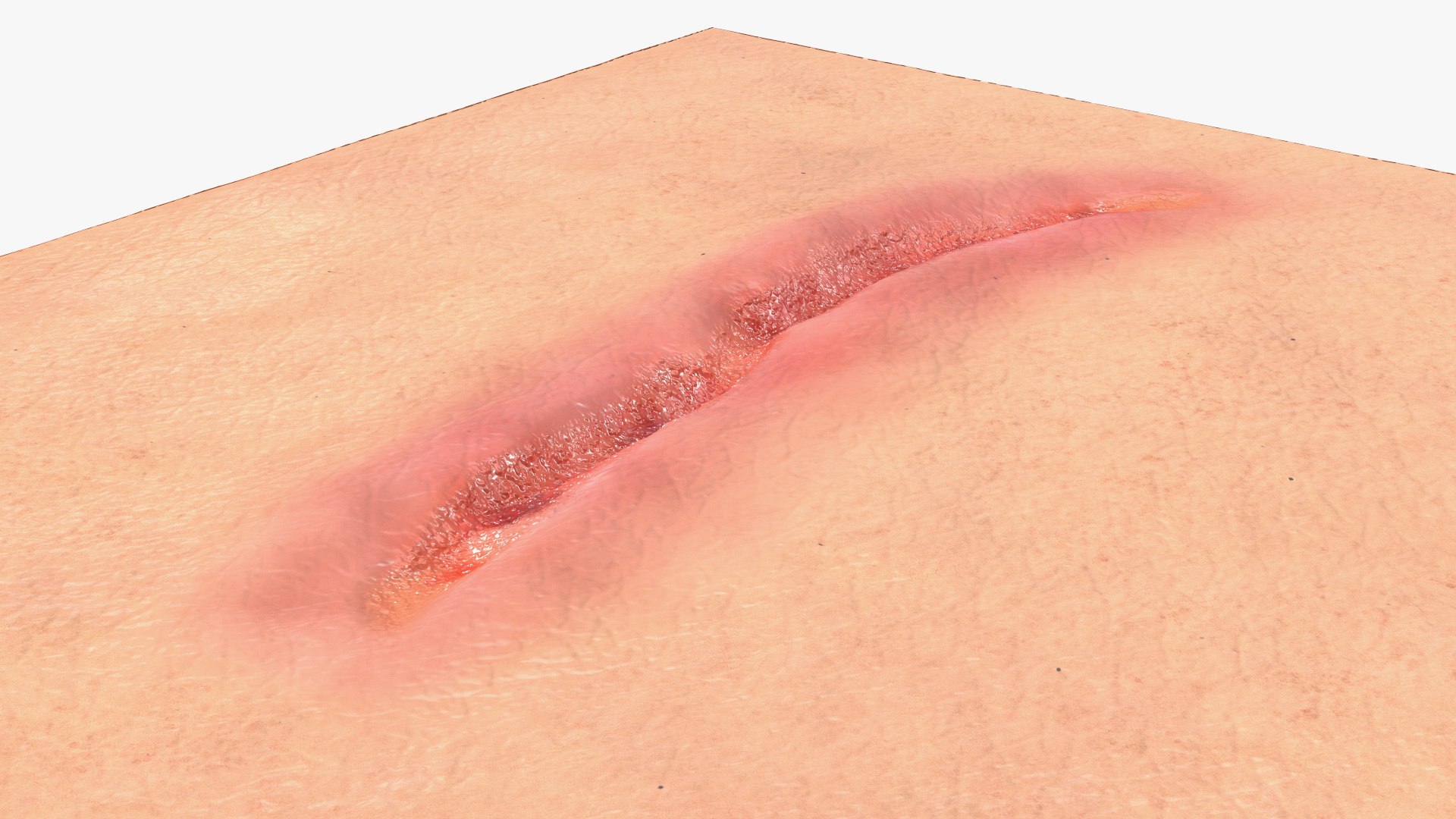 Medical Cut Skin Surfaces Collection 3D https://p.turbosquid.com/ts-thumb/7i/9Jetg6/wS/medicalcutskinsurfacescollectionc4dmodel036/jpg/1704342792/1920x1080/fit_q87/e9309873358994e8b15341a9f70fb09cbbec14a6/medicalcutskinsurfacescollectionc4dmodel036.jpg