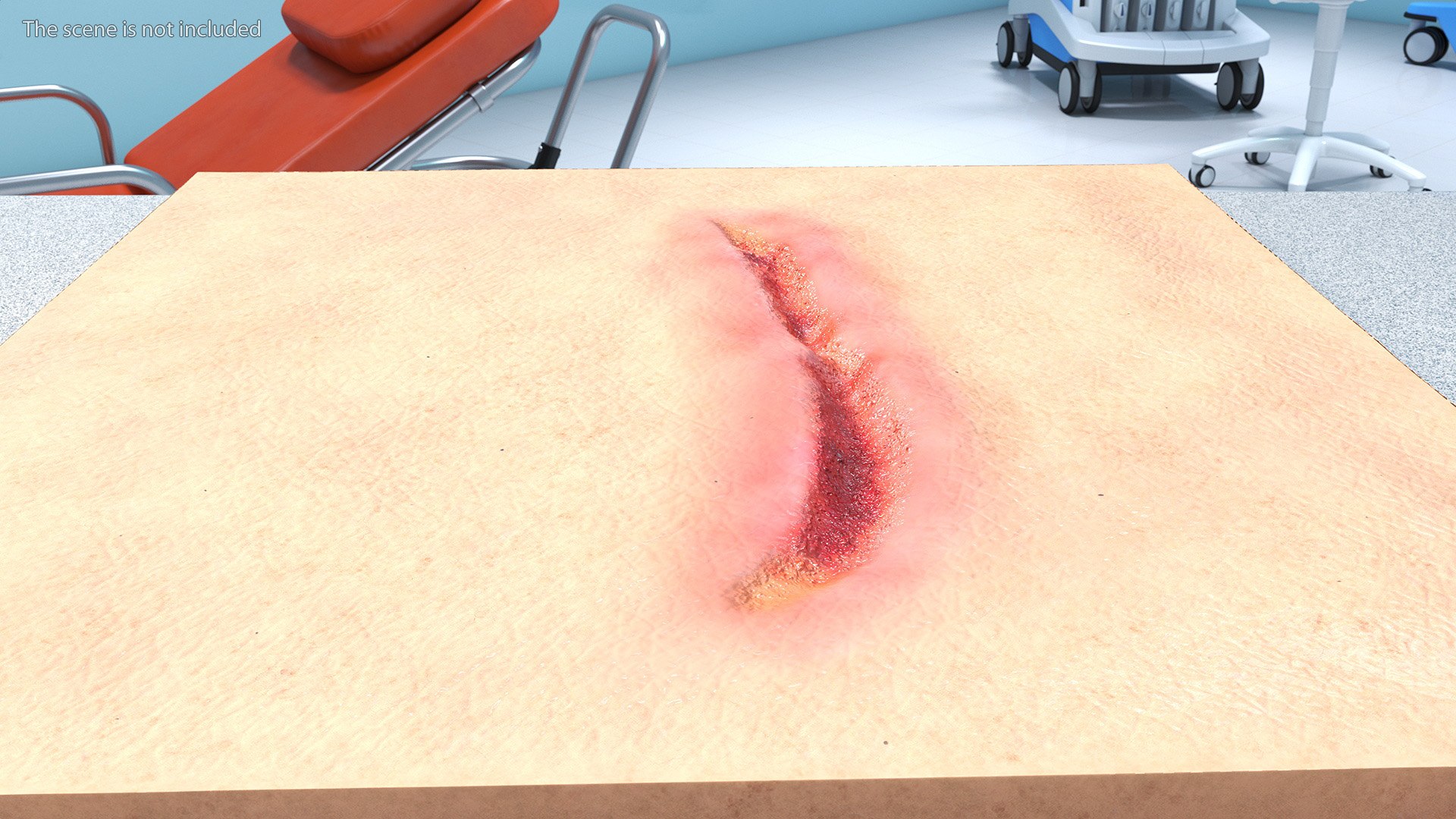 Medical Cut Skin Surfaces Collection 3D https://p.turbosquid.com/ts-thumb/7i/9Jetg6/yT/medicalcutskinsurfacescollectionc4dmodel028/jpg/1704342763/1920x1080/fit_q87/ee58069ffe712bb39de3bb77d5e908e617ce117b/medicalcutskinsurfacescollectionc4dmodel028.jpg