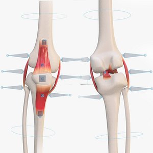 Knee anatomy template 3D