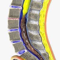 Intervertebral herniation slipped ruptured disc