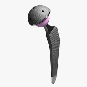 max femoral prosthesis