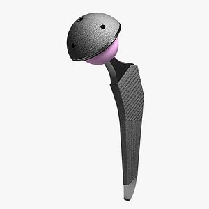Femoral Prosthesis