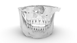 Real CT Scan Adult Male Maxilla and Mandible Jaw 3D Model