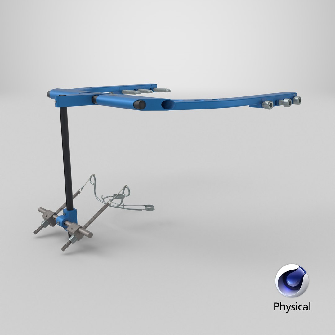 3D Rigid Distraction Frame for Cranial Surgery Blue model https://p.turbosquid.com/ts-thumb/86/WHpCSt/a9/stemcell_cinema_4d_physical_render/png/1771964906/1920x1080/fit_q87/a6494922c3227aaed9e853b050482f7d90c86a8e/stemcell_cinema_4d_physical_render.jpg