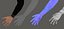 Arm