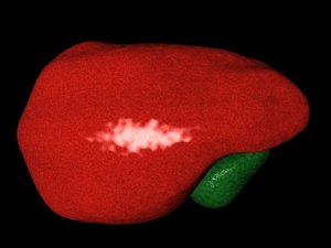 liver bladder 3d model