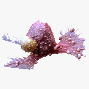 Cancer Cell Tumor 3D model
