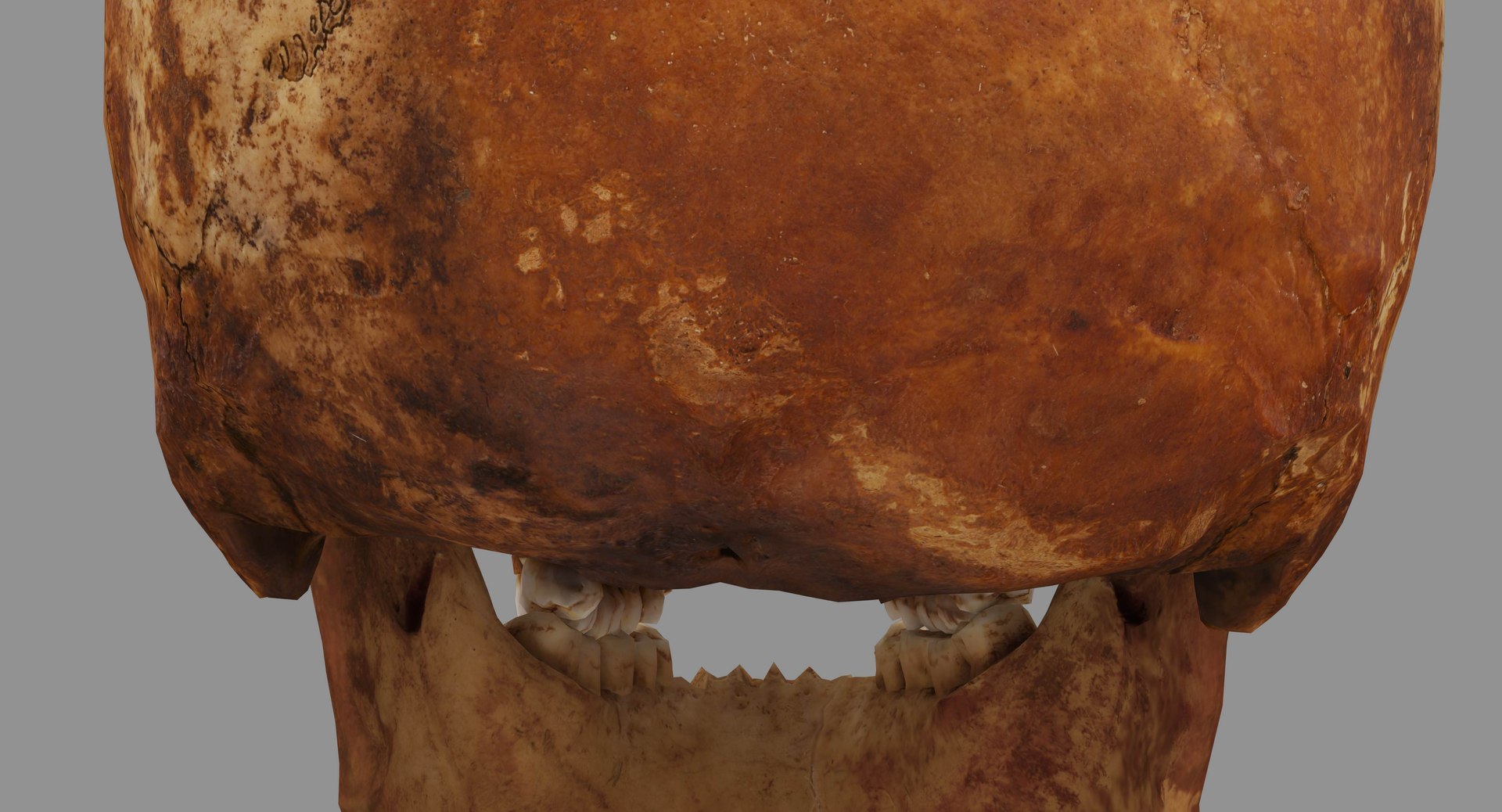 human skull scanned 3D https://p.turbosquid.com/ts-thumb/8T/U6nMKO/FUazeLDu/100022/jpg/1570537857/1920x1080/fit_q87/7bf5fb55aa72267cd3e7454ae82e9f087adc1fd1/100022.jpg