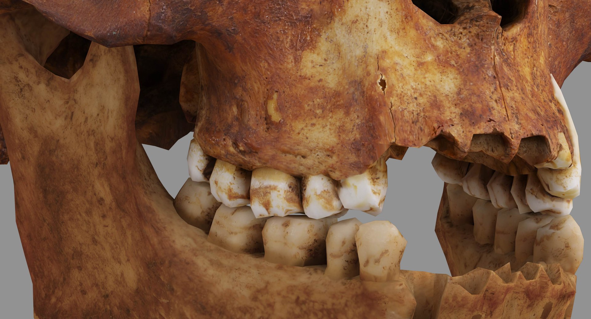 human skull scanned 3D https://p.turbosquid.com/ts-thumb/8T/U6nMKO/MgAPqZfj/100008/jpg/1570537857/1920x1080/fit_q87/7a4ff89bcfe068a876be73670be1560f000ac4f9/100008.jpg