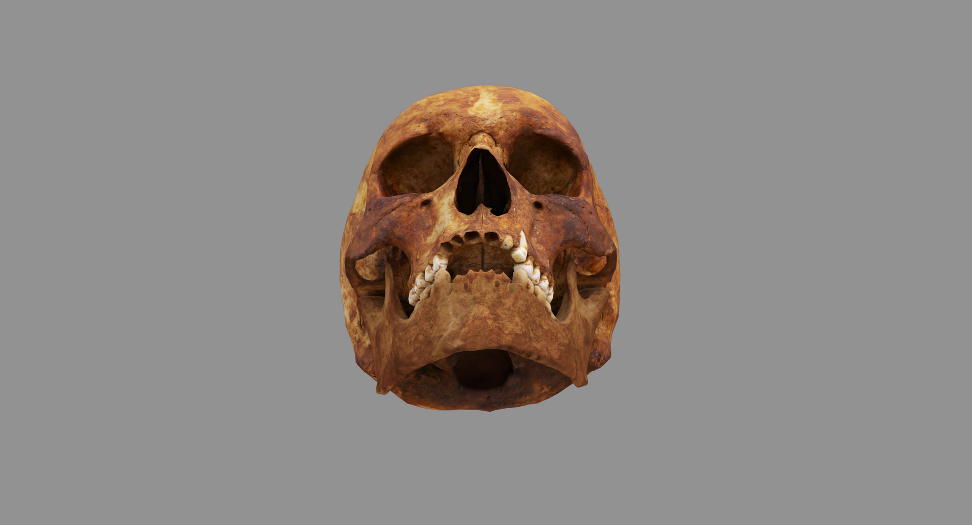 human skull scanned 3D https://p.turbosquid.com/ts-thumb/8T/U6nMKO/S9OZnYz4/100000/jpg/1570537751/1920x1080/turn_fit_q99/c3a76a140d9312fe8d792cb5d3bed8a5c2201dc1/100000-1.jpg