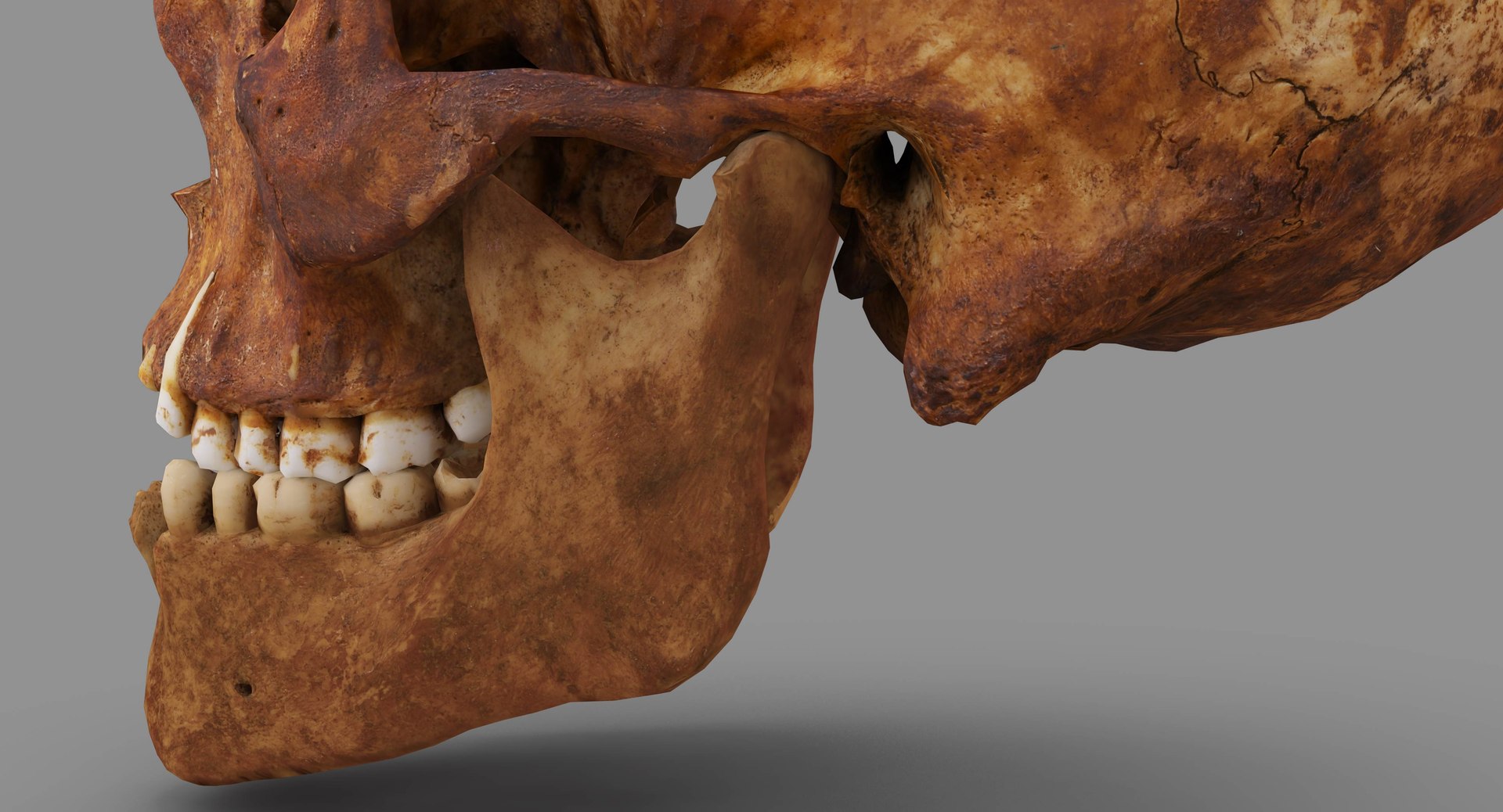 human skull scanned 3D https://p.turbosquid.com/ts-thumb/8T/U6nMKO/ULFSYCK2/100029/jpg/1570537858/1920x1080/fit_q87/accfe3cd5e0b95c23a012ee227e42285c7689e32/100029.jpg