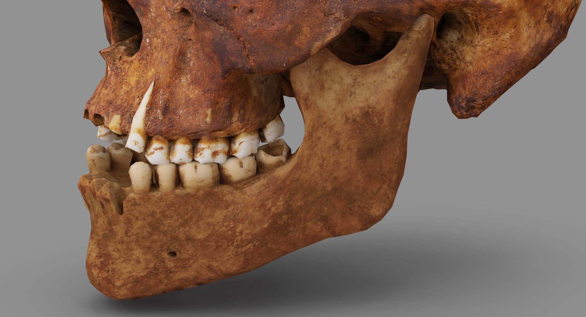 human skull scanned 3D https://p.turbosquid.com/ts-thumb/8T/U6nMKO/cKwXjSzY/100034/jpg/1570537858/1920x1080/fit_q87/188525ff9ac4b304e921436febd7e86cd6e6599c/100034.jpg