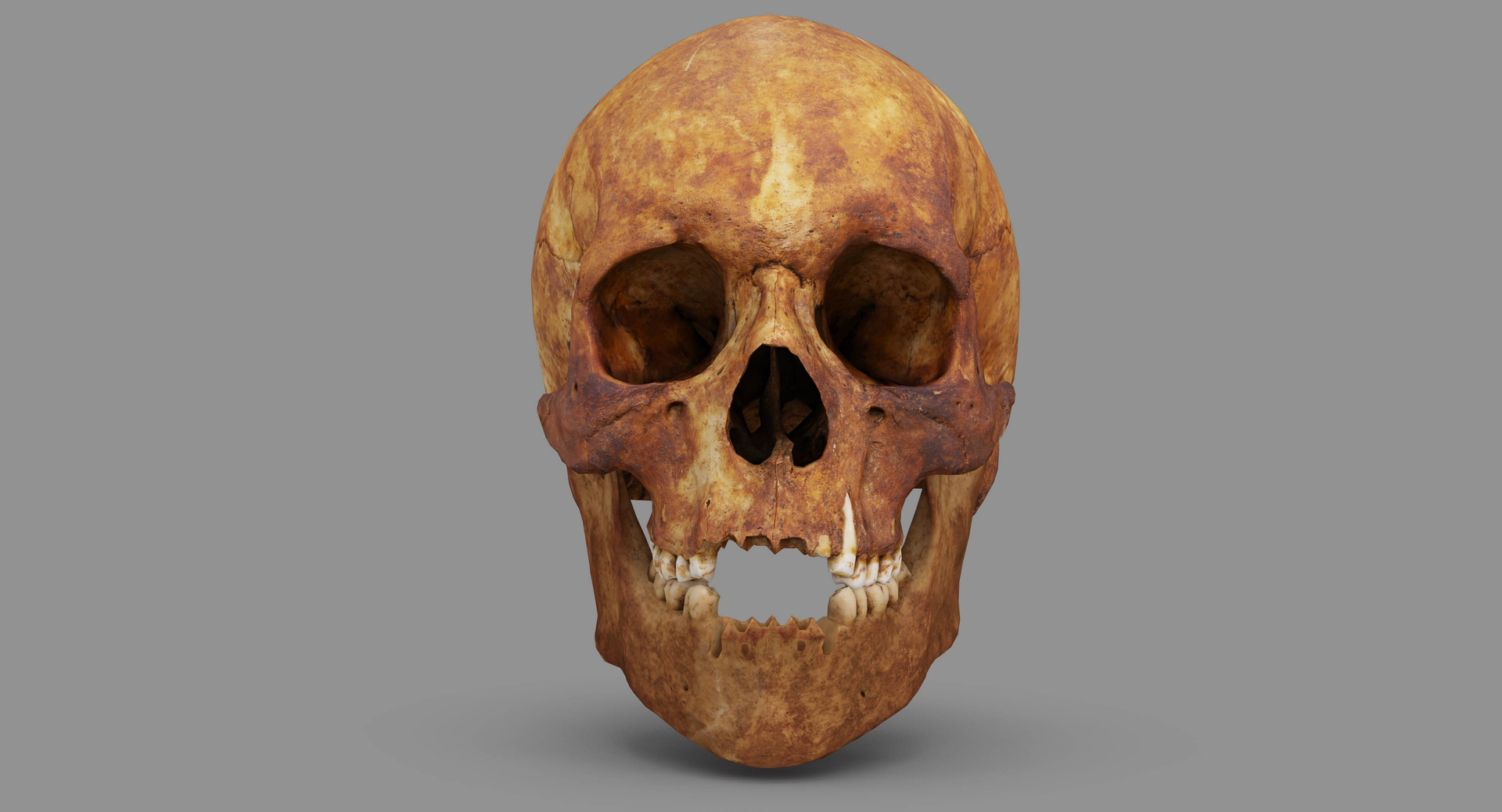 human skull scanned 3D https://p.turbosquid.com/ts-thumb/8T/U6nMKO/dQoRiO3O/100023/jpg/1570537274/1920x1080/turn_fit_q99/1593dcf868febc9fdd46c343da2f54fb3afbaceb/100023-1.jpg