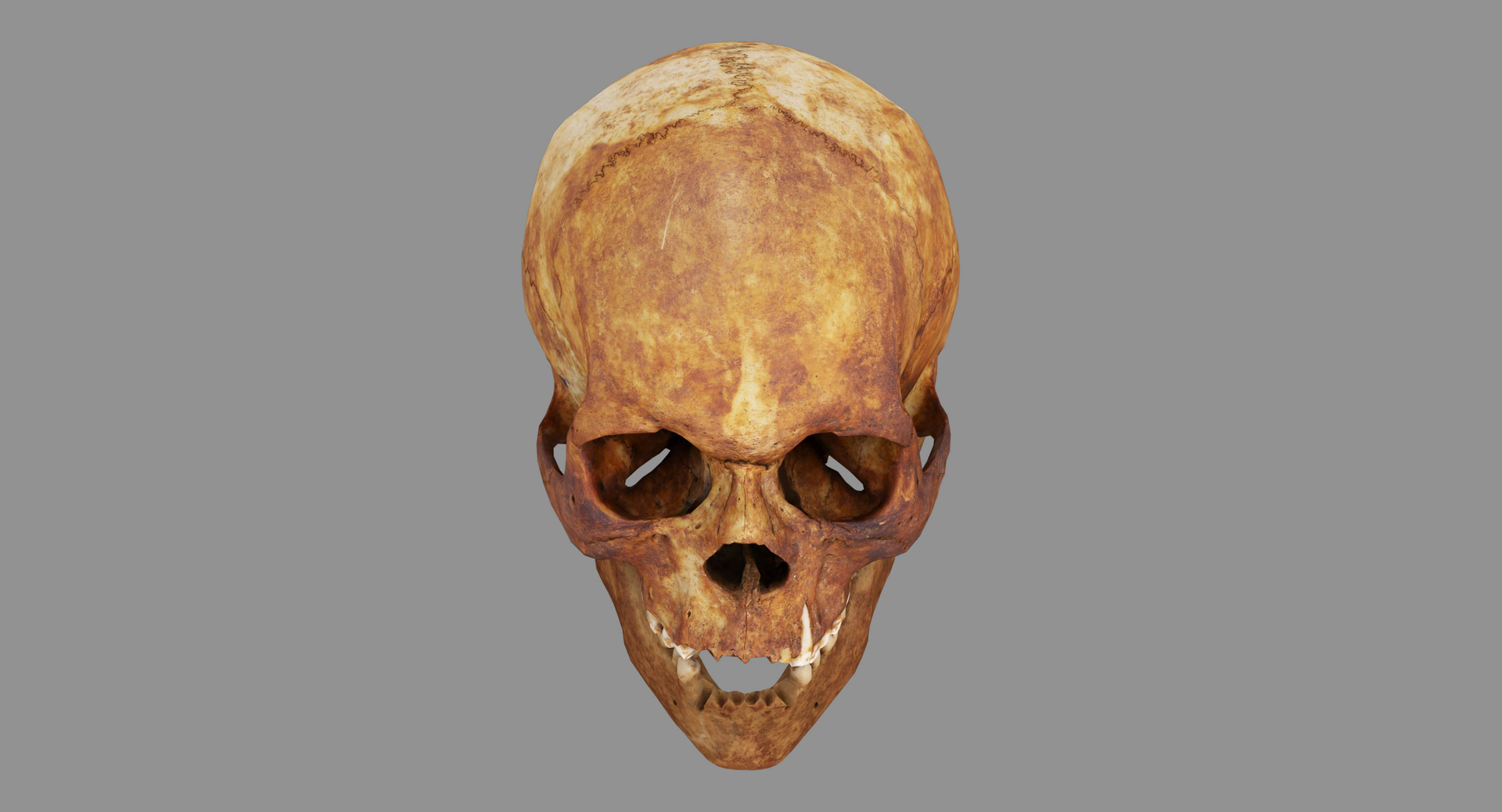 human skull scanned 3D https://p.turbosquid.com/ts-thumb/8T/U6nMKO/uhoI7kj9/100000/jpg/1570537312/1920x1080/turn_fit_q99/0c8c72e137fa32e13113cb95d7d2efa554e12565/100000-1.jpg