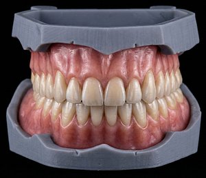 Full Denture Set - Upper and Lower Anatomy STL 3D model