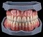 Full Denture Set - Upper and Lower Anatomy STL 3D model