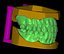 Full Denture Set - Upper and Lower Anatomy STL 3D model