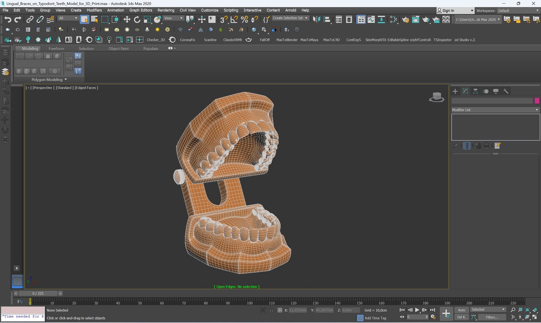 Lingual Braces on Typodont Teeth Model for 3D Print 3D model https://p.turbosquid.com/ts-thumb/8Y/sJmw1i/wr/lingual_braces_on_typodont_teeth_model_for_3d_print_002/jpg/1738639746/1920x1080/fit_q87/83c26b3118f2ea3f4ea9777dd49226afe649148a/lingual_braces_on_typodont_teeth_model_for_3d_print_002.jpg