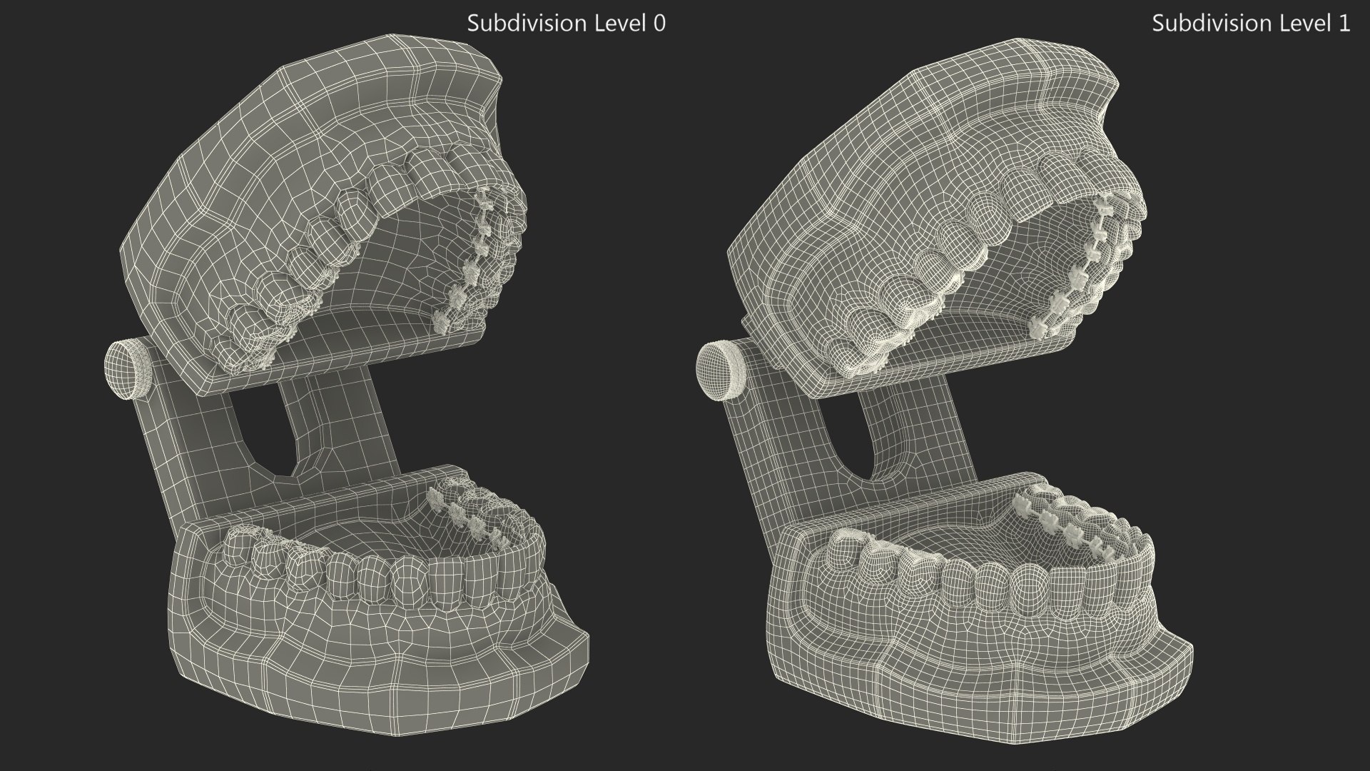 3D Lingual Braces On Typodont Teeth Model - TurboSquid 2335702