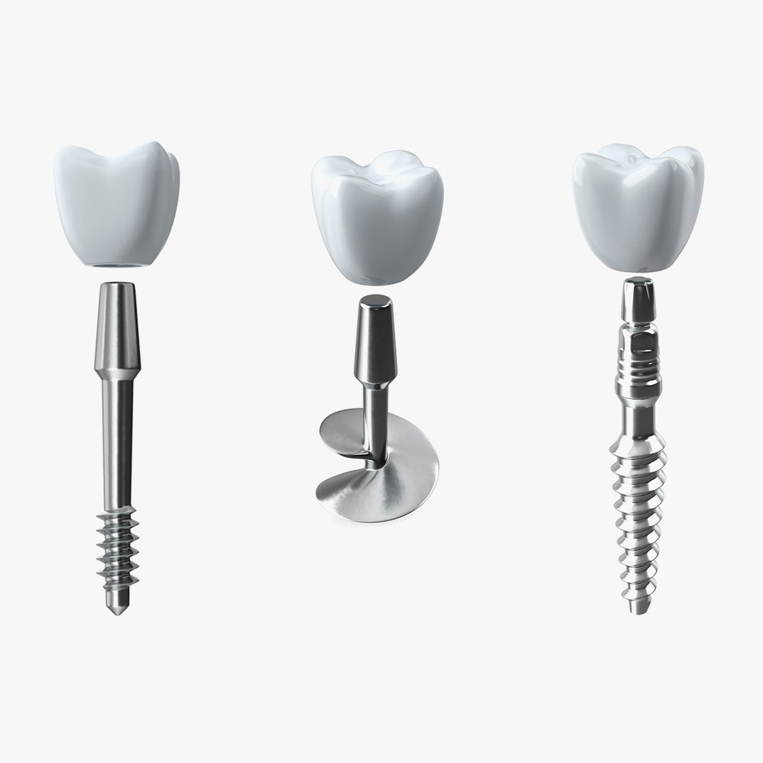 Dental Implants Collection 3D model preview
