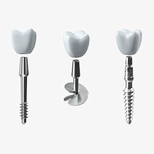 Dental Implants Collection 3D model