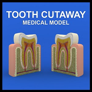 Tooth Cutaway