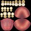 Animation de dentature
