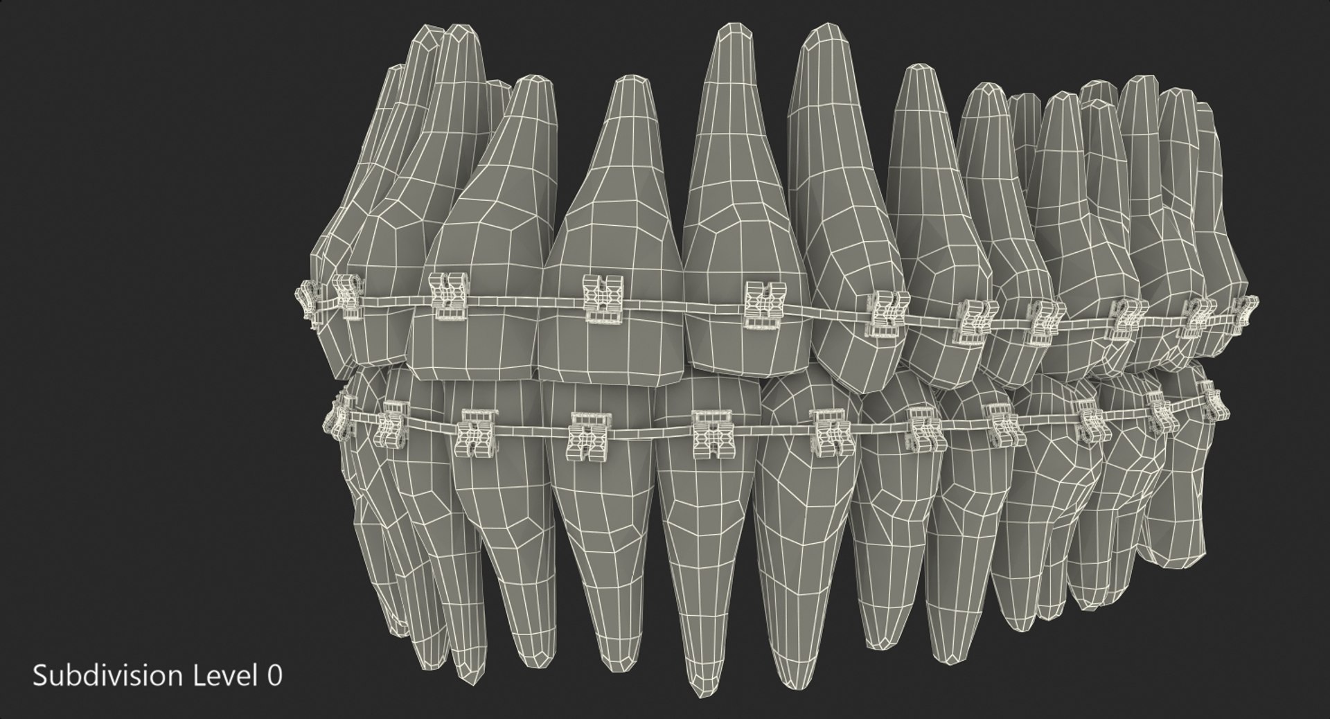 teeth braces modeled model https://p.turbosquid.com/ts-thumb/91/M2I0E3/4dqSczf1/teethwithbracesmodel3dsmodel013/jpg/1527004779/1920x1080/fit_q87/4c3fabdf26ec20c65353e4bb2c883aebf2fcbda8/teethwithbracesmodel3dsmodel013.jpg