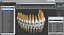 Teeth with Braces Model 3D