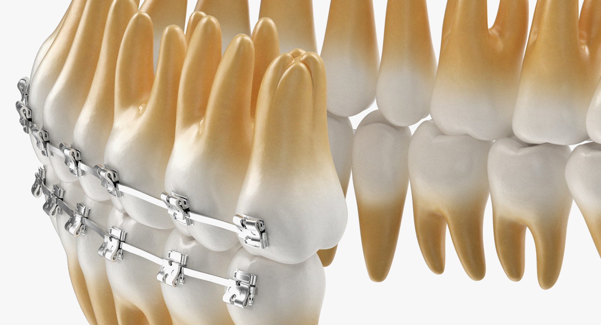 teeth braces modeled model https://p.turbosquid.com/ts-thumb/91/M2I0E3/JLYfJiqA/teethwithbracesmodel3dsmodel007/jpg/1527004757/1920x1080/fit_q87/5be42e211aab5229c5348f2798941eb289c7a64e/teethwithbracesmodel3dsmodel007.jpg