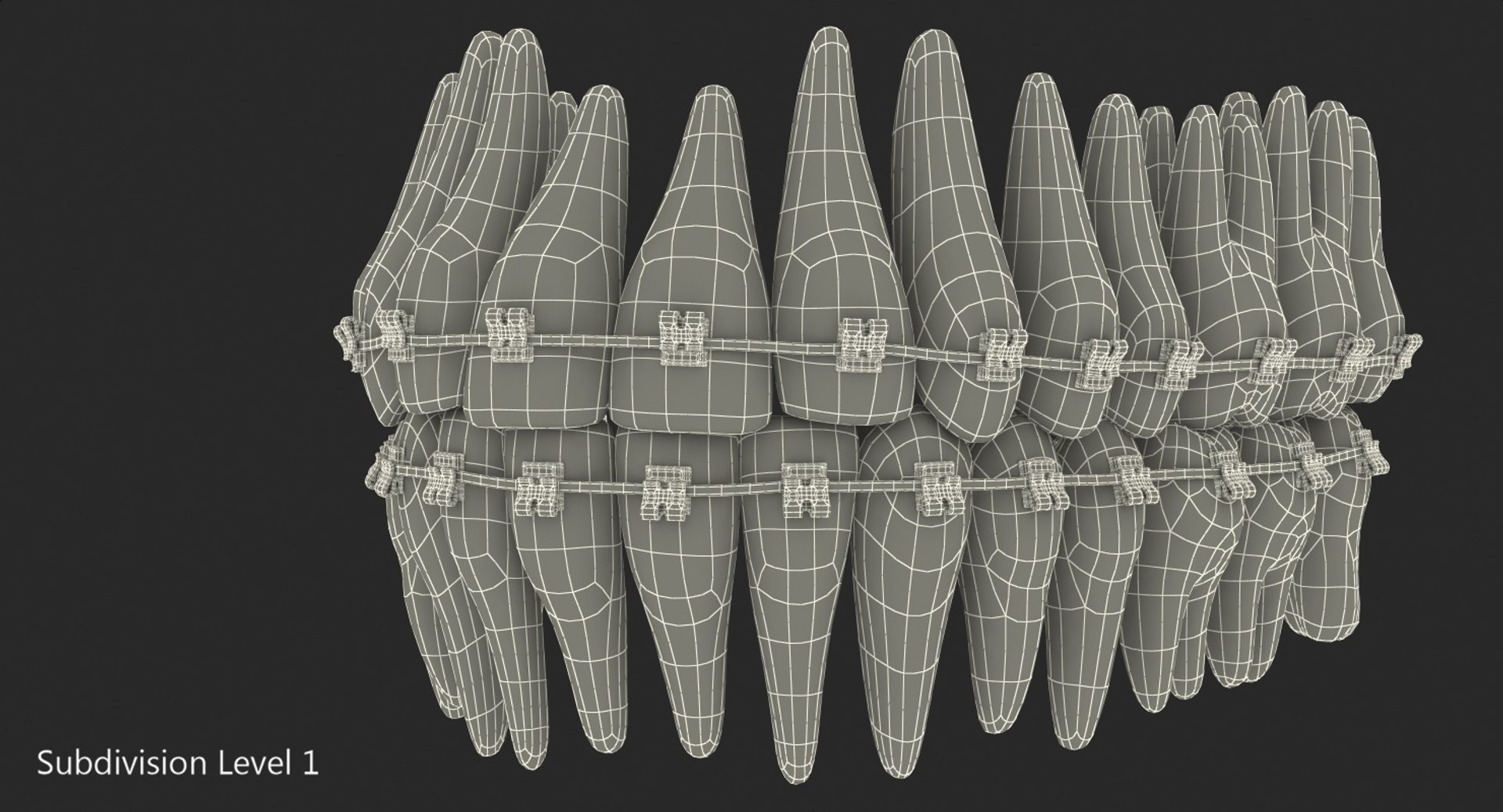 teeth braces modeled model https://p.turbosquid.com/ts-thumb/91/M2I0E3/TkwyKe0D/teethwithbracesmodel3dsmodel014/jpg/1527004782/1920x1080/fit_q87/2c158f6b1d701b580e2db0589b53d6c321355abe/teethwithbracesmodel3dsmodel014.jpg