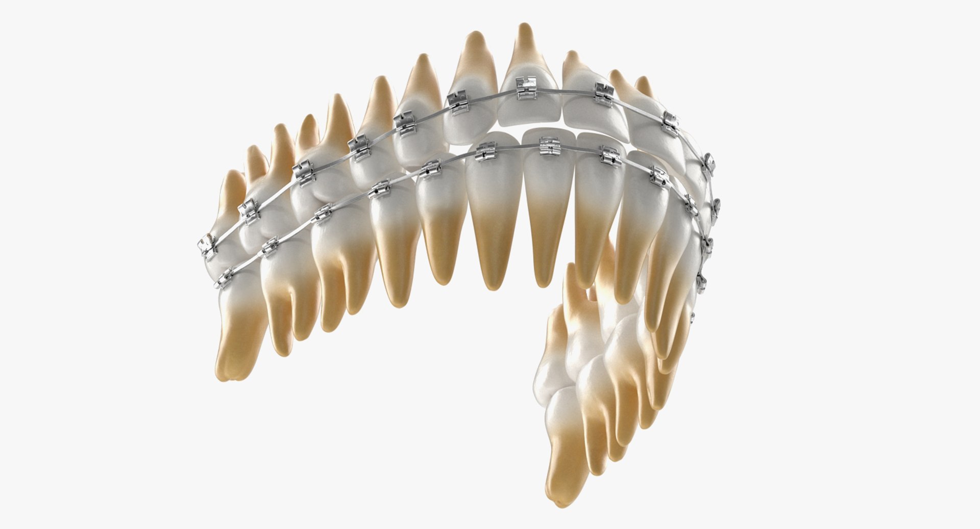 teeth braces modeled model https://p.turbosquid.com/ts-thumb/91/M2I0E3/Y97YpE5O/teethwithbracesmodel3dsmodel004/jpg/1527004746/1920x1080/fit_q87/bce19167fc846afbabe194e390f05190ecc0afed/teethwithbracesmodel3dsmodel004.jpg