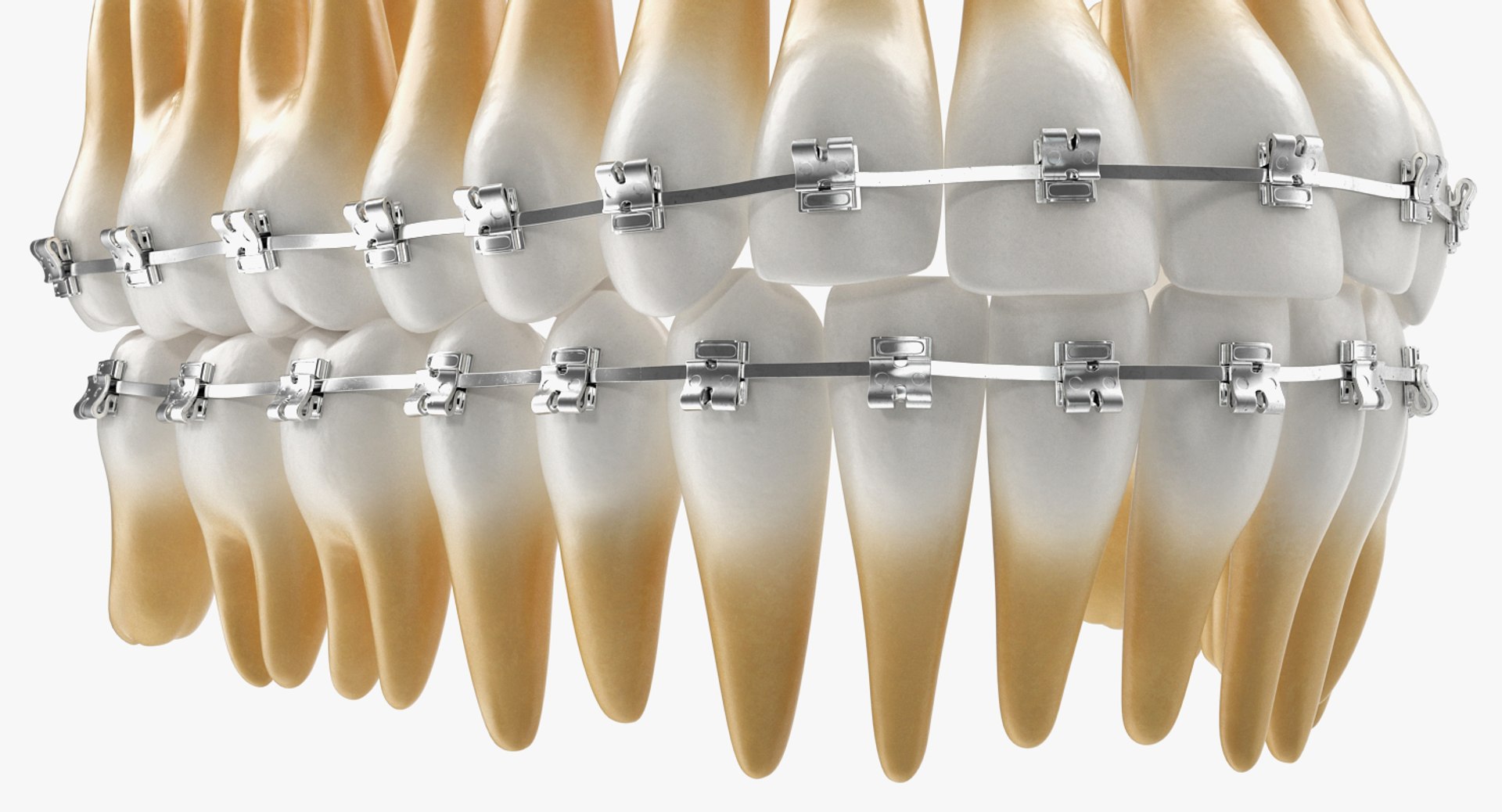 teeth braces modeled model https://p.turbosquid.com/ts-thumb/91/M2I0E3/Ywoz2TRd/teethwithbracesmodel3dsmodel009/jpg/1527004765/1920x1080/fit_q87/9e9ea393a739d861318ca5063b153402b939fab8/teethwithbracesmodel3dsmodel009.jpg