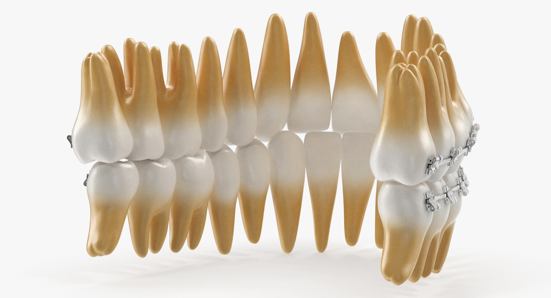teeth braces modeled model https://p.turbosquid.com/ts-thumb/91/M2I0E3/gUz0BA7U/teethwithbracesmodel3dsmodel003/jpg/1527004742/1920x1080/fit_q87/e44d2f9b1b62785b9e02d46e3c36cc91ff72d657/teethwithbracesmodel3dsmodel003.jpg