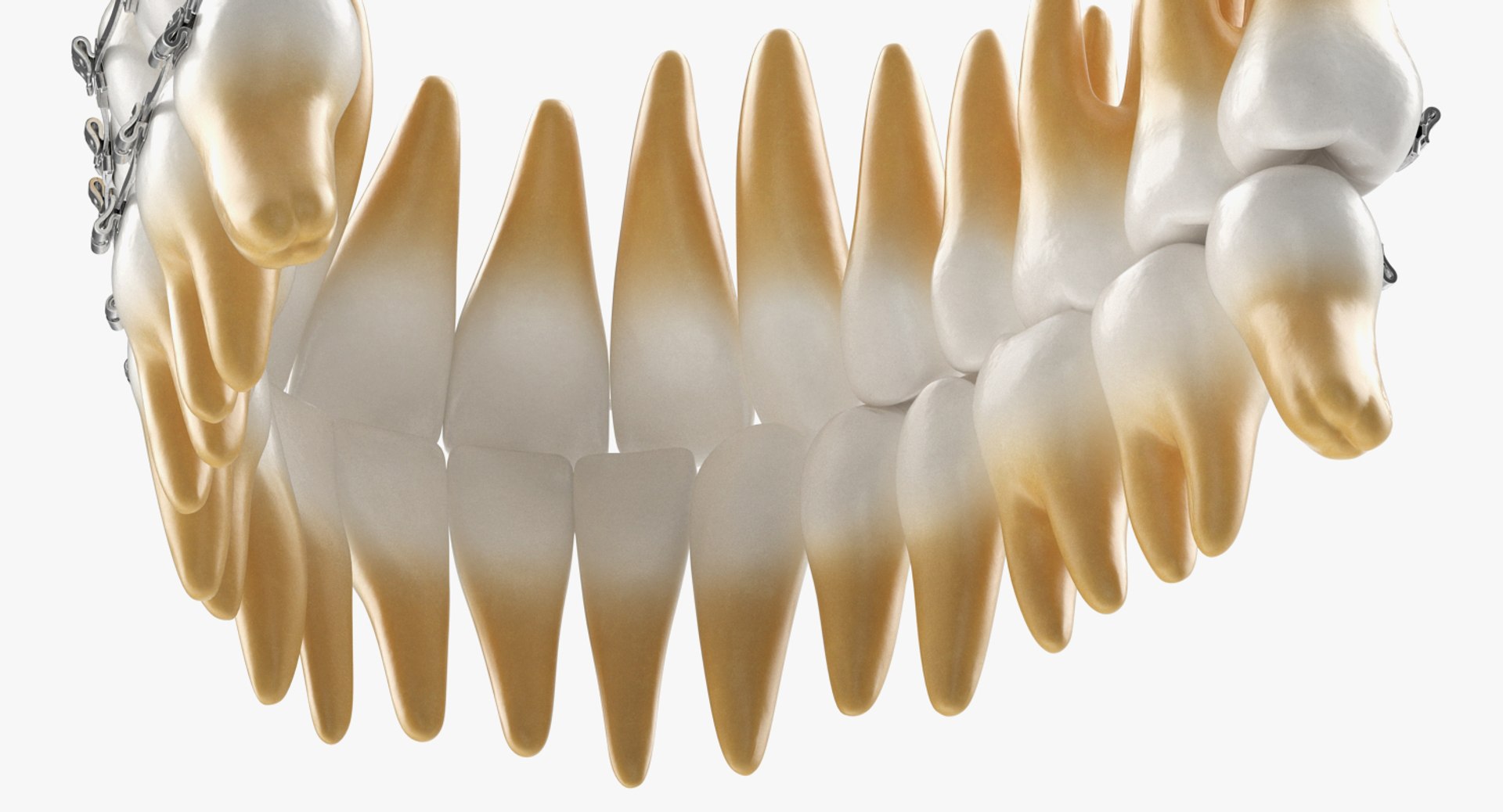 teeth braces modeled model https://p.turbosquid.com/ts-thumb/91/M2I0E3/hoi7Tz7L/teethwithbracesmodel3dsmodel006/jpg/1527004753/1920x1080/fit_q87/b4aafede880560145a55d40c997cb52173c3b110/teethwithbracesmodel3dsmodel006.jpg