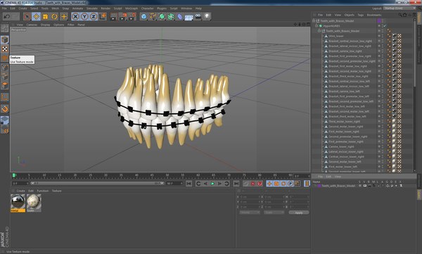 Teeth braces modeled model - TurboSquid 1289755