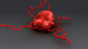 obj breast cancer cells