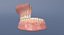 incisor section - model