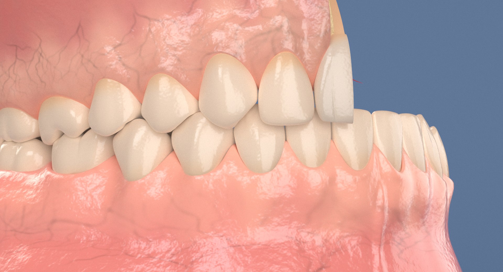 Incisor Section Model TurboSquid 1404732