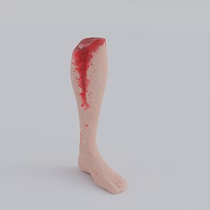 Accident Leg model