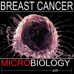 breast cancer cell