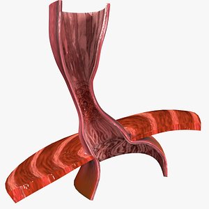 Gastro oesophageal reflux disease 3D model