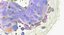 Basophil